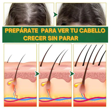 OUHOE HAIR™ - Suero para el crecimiento del cabello